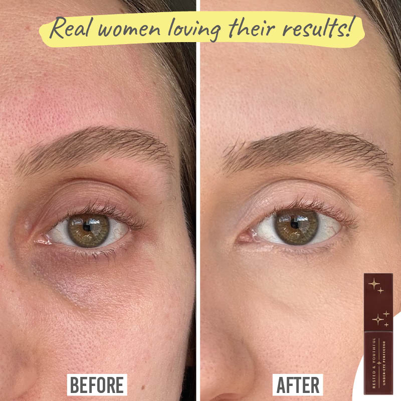 Rested & Youthful Under Eye Perfector