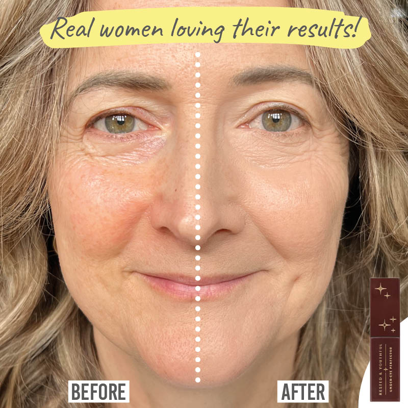 Rested & Youthful Under Eye Perfector